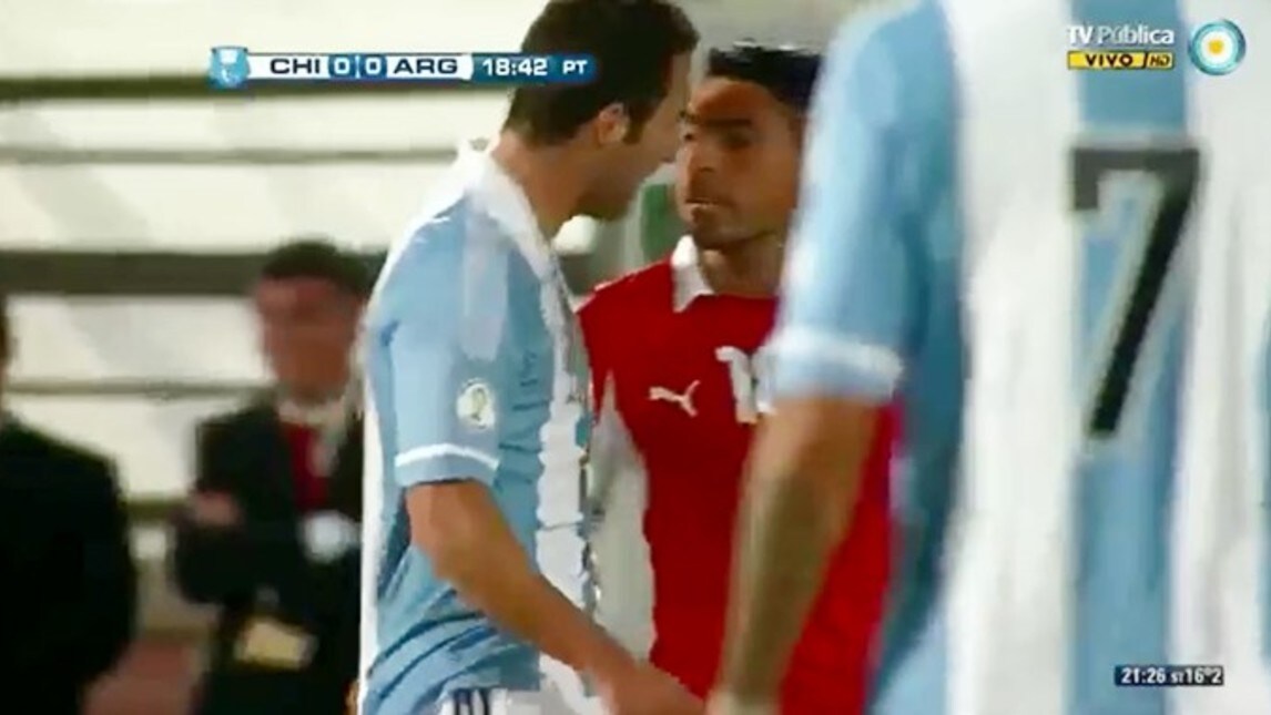 Higuain come Cavani, prima "vittima" di Jara