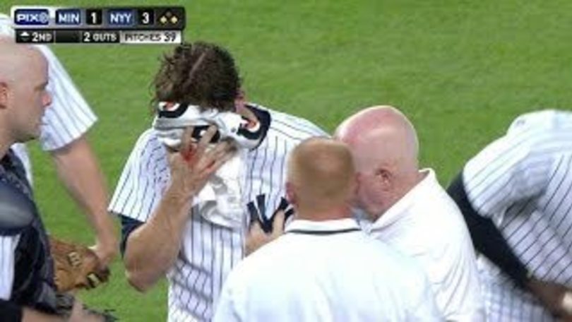 Baseball, Mitchell colpito al volto dalla pallina