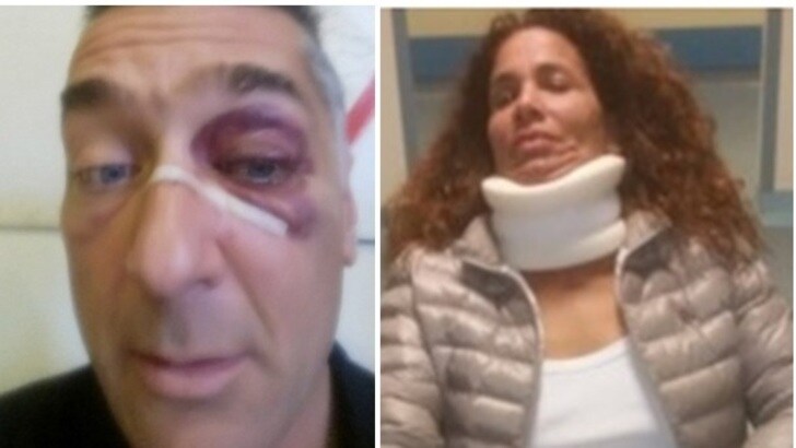 Torino-Juventus, rissa e insulti razzisti nel derby dei Pulcini