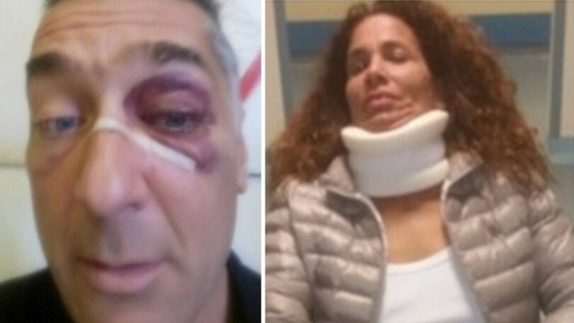 Torino-Juventus, rissa e insulti razzisti nel derby dei Pulcini