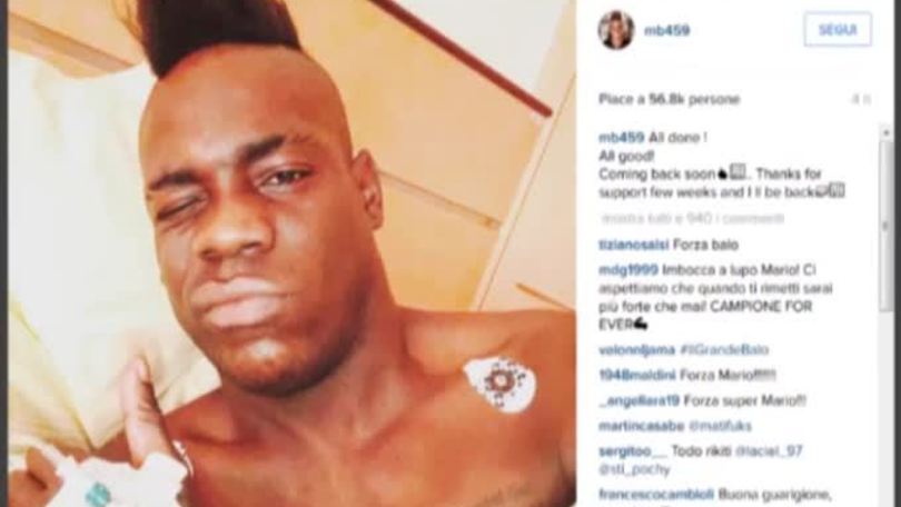 Milan, operazione riuscita per Balotelli