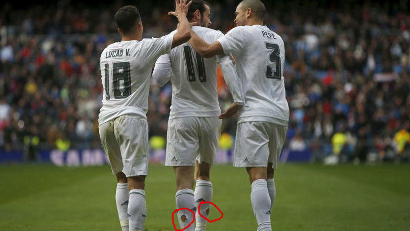 Bale come Nainggolan e Piovaccari: calzettoni bucati per salvare i muscoli del polpaccio