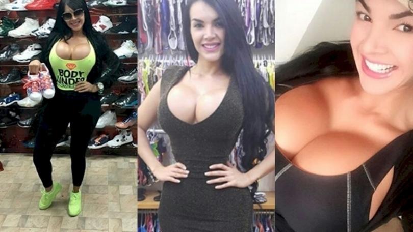La modella che ha fatto 20 interventi chirurgici