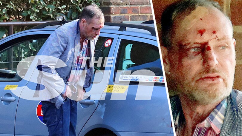 Gascoigne: «Ora basta, non farò la fine di George Best»
