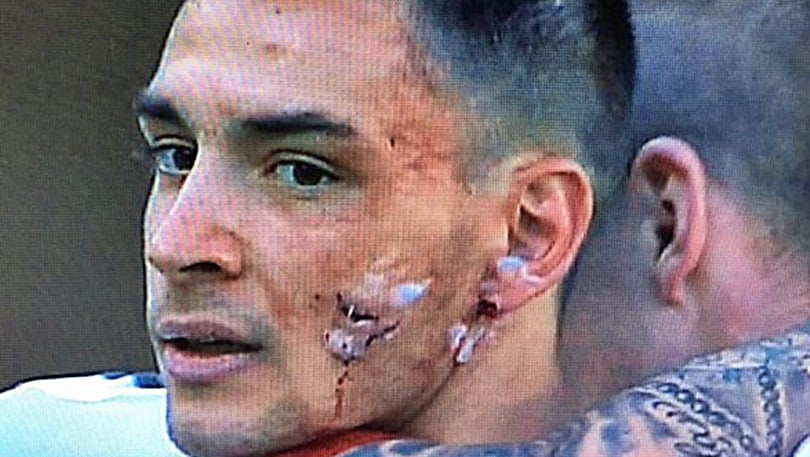 Milan, scarpata di Wszolek a De Sciglio: infortunio impressionante