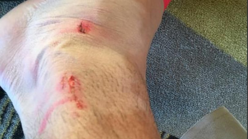 Euro 2016, Khedira maltrattato dai polacchi, mostra la caviglia sui social