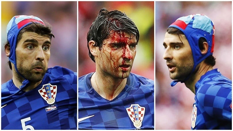 Euro 2016, Corluka con la cuffia da pallanuoto: il sangue alla testa si ferma così!
