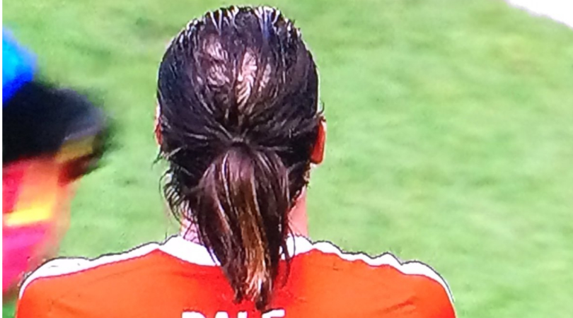 Gareth Bale e lo chiffon-riporto: la calvizie avanza....