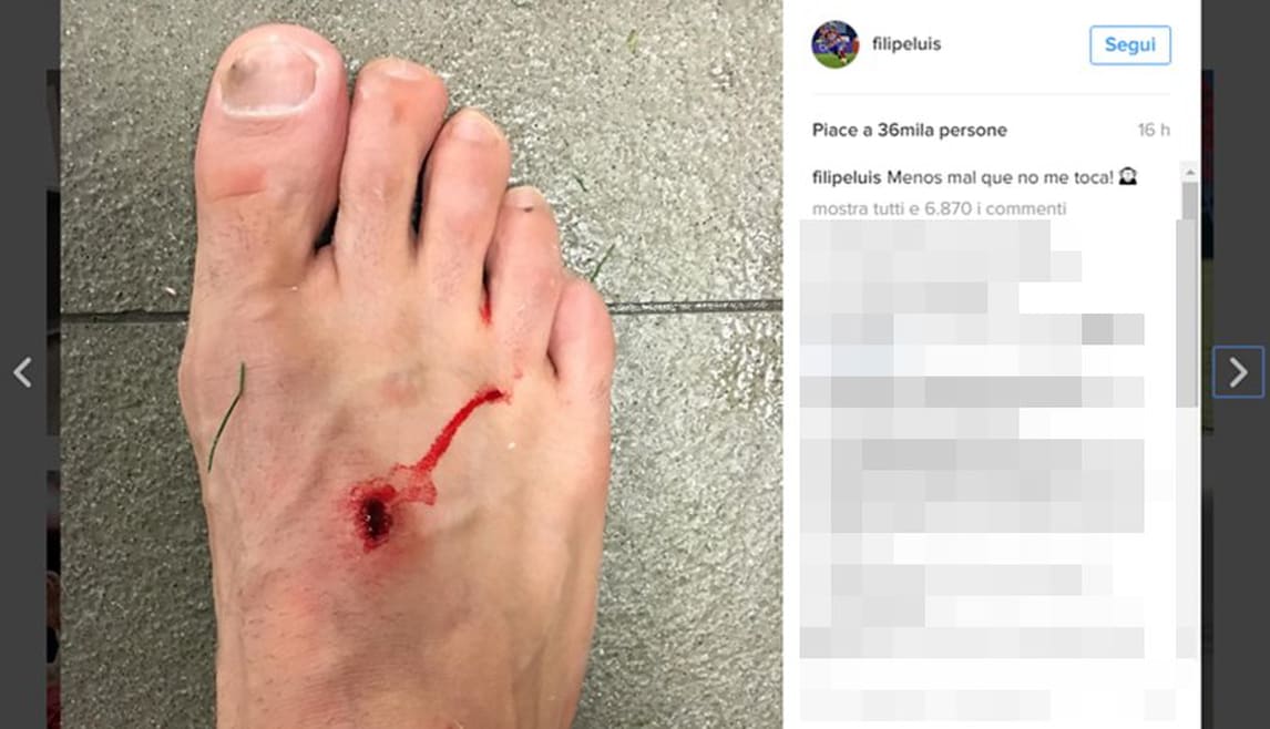 Liga, scintille Filipe Luis-Suarez: il difensore pubblica la foto della ferita