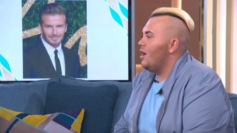 Inghilterra, spende 23mila euro per assomigliare a Beckham
