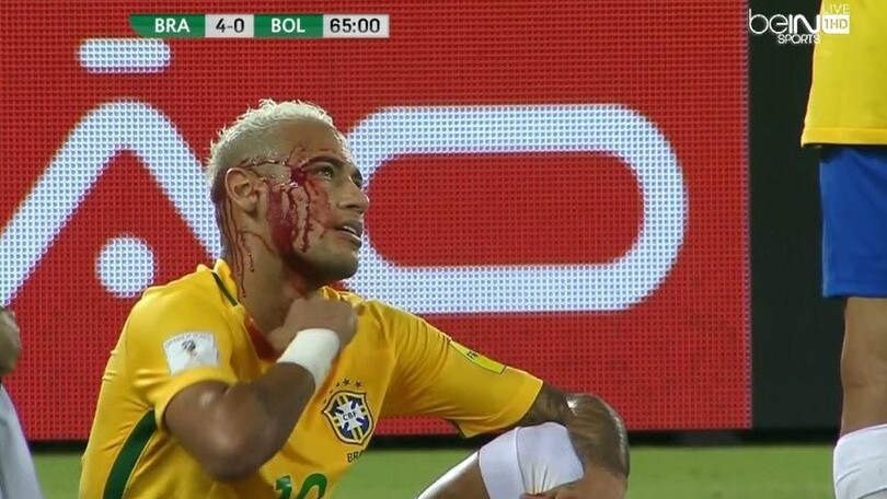 Neymar insanguinato, che botta con la Bolivia