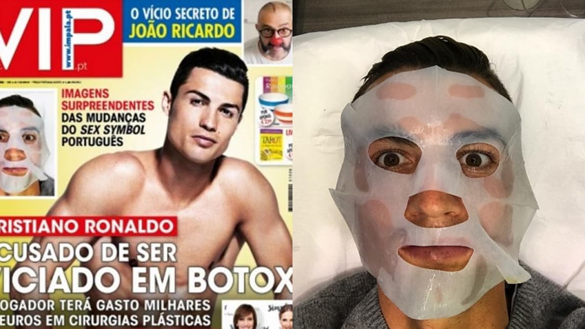 Liga, Real Madrid. In Portogallo: «Cristiano Ronaldo schiavo del botox»