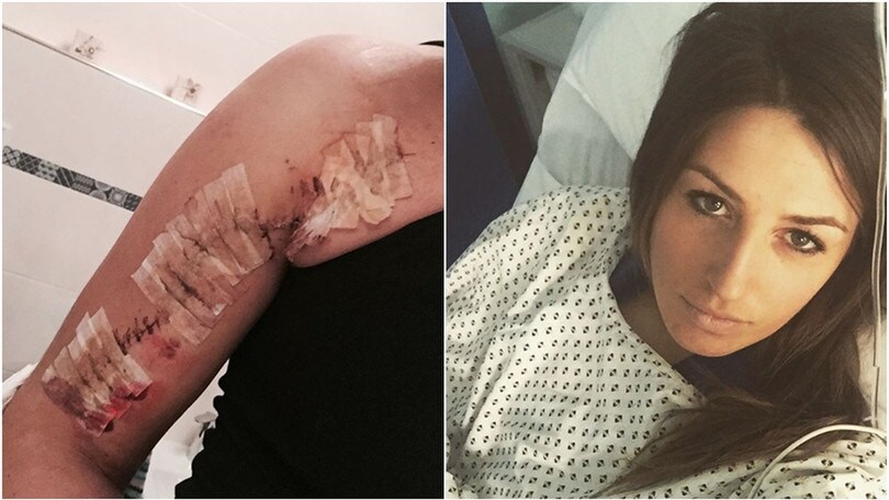 Nadia Fanchini shock su Instagram: ecco la cicatrice dopo l'operazione