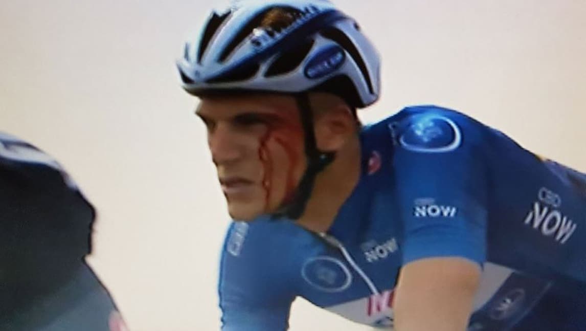 Ciclismo, Dubai Tour: Kittel sanguina. Grivko espulso per un pugno