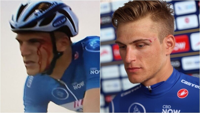 Ciclismo, Dubai Tour: Kittel ferito dopo il pugno di Grivko