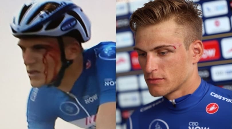 Ciclismo, Dubai Tour: Kittel ferito dopo il pugno di Grivko