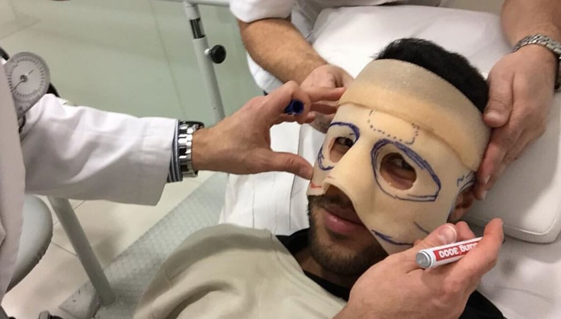 Rafinha in versione supereroe: «Marvel, sono pronto»