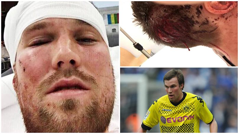 Stoccarda, Grosskreutz coinvolto in una rissa: ricoverato in ospedale