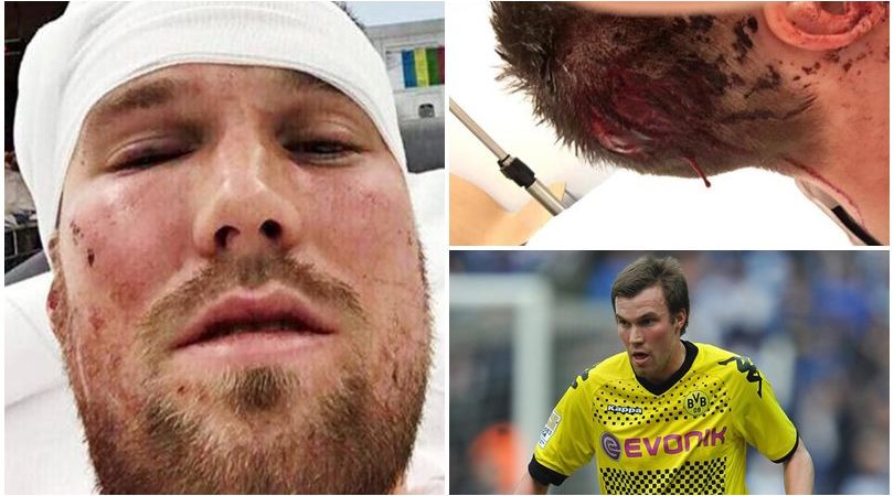 Stoccarda, Grosskreutz coinvolto in una rissa: ricoverato in ospedale