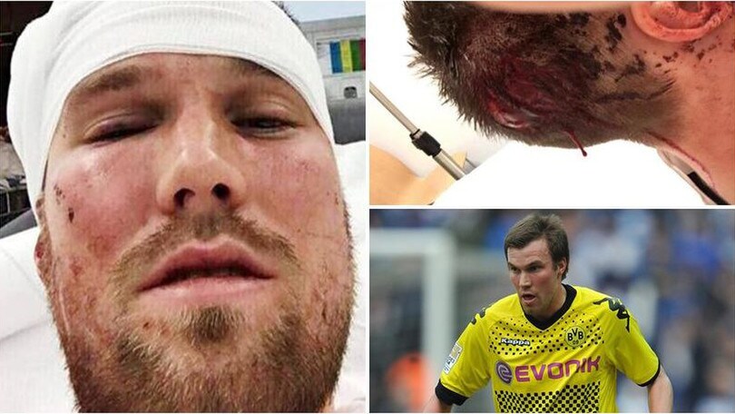 Stoccarda, caso-Grosskreutz: ufficiale la rescissione consensuale del contratto, poi il ritiro