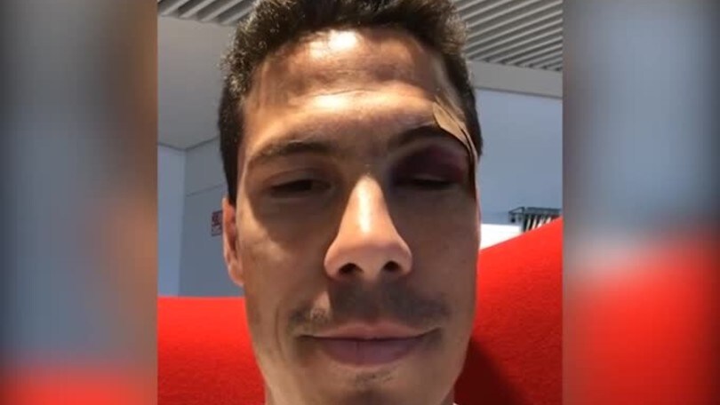Hernanes, che botta!