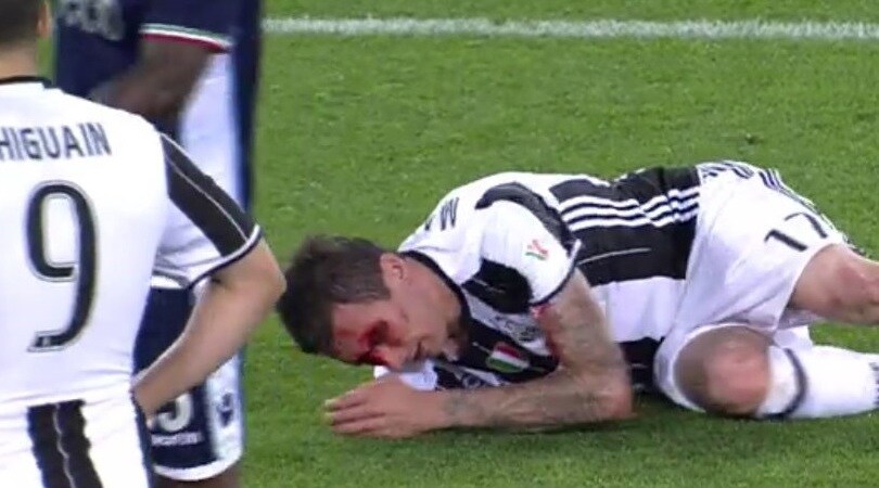 Juventus-Lazio, paura Mandzukic: sanguina in campo