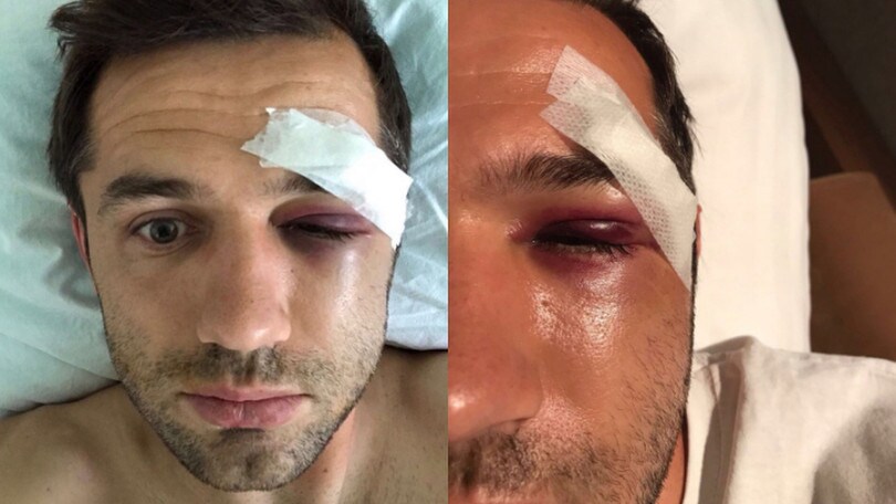 Guardate Torosidis come ha ridotto Lulic!