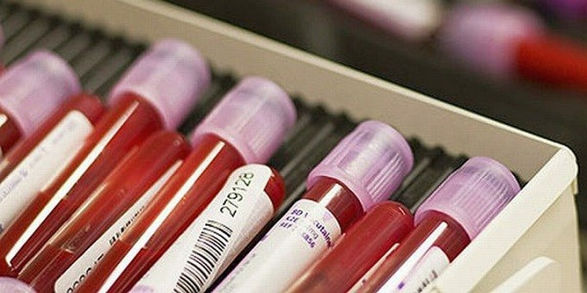 Ciclismo, l'ultima frontiera del doping: positivo un 14enne