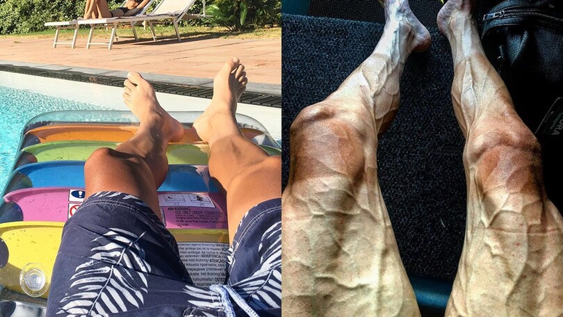 Tour de France, le foto shock delle gambe di Poljanski