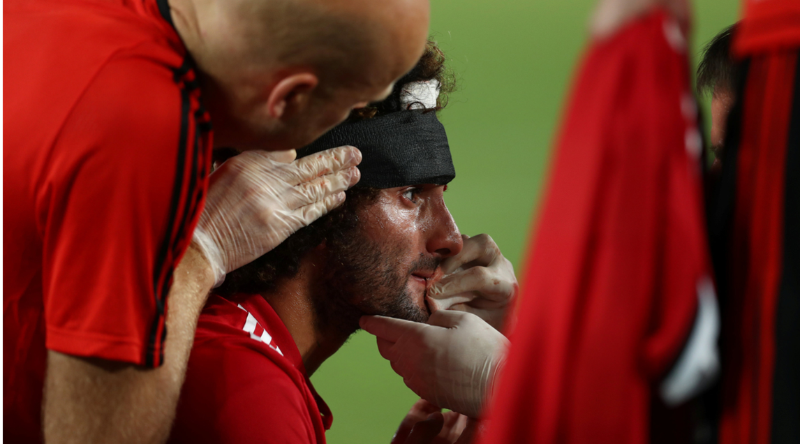 Supercoppa Europea, nuova pettinatura per Fellaini dopo la testata a Sergio Ramos