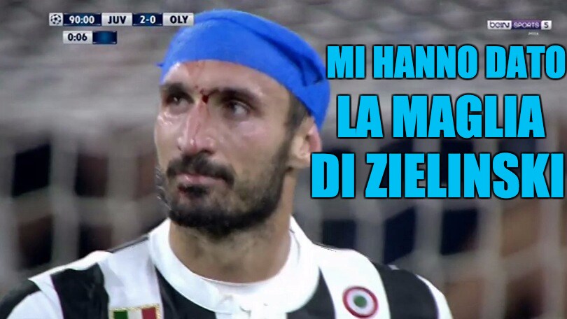 Chiellini, primo turbante della stagione e i social si scatenano