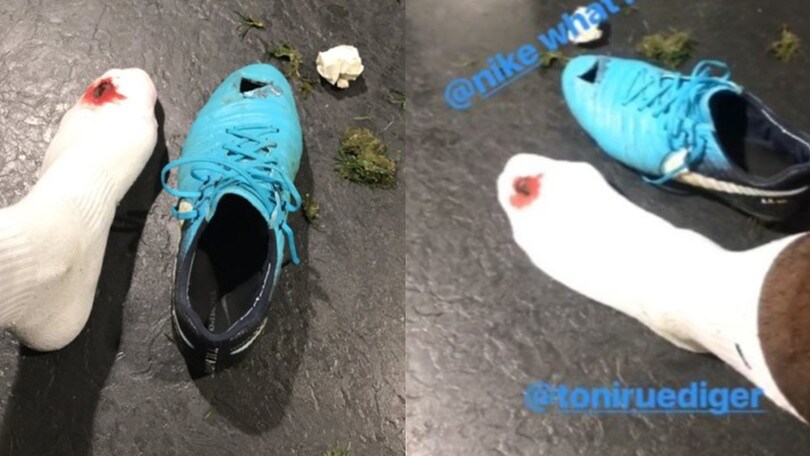 Rüdiger, prima il gol poi la ferita da horror al piede