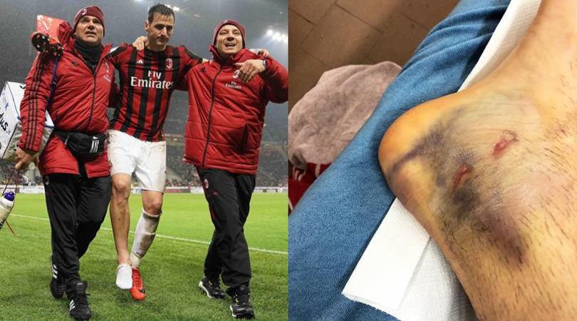 Milan, Kalinic ko: ecco com'è ridotta la sua caviglia