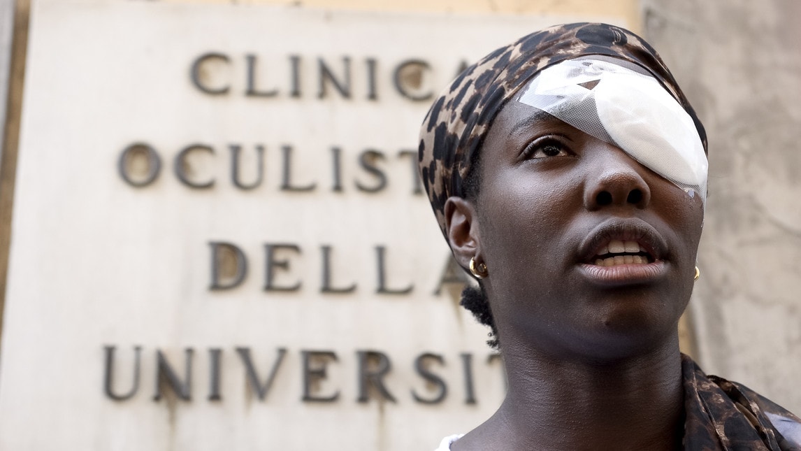 Daisy Osakue aggredita: ecco le foto all'uscita dal pronto soccorso