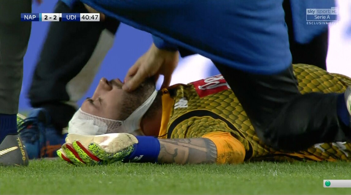 Napoli, paura per Ospina: colpito alla testa