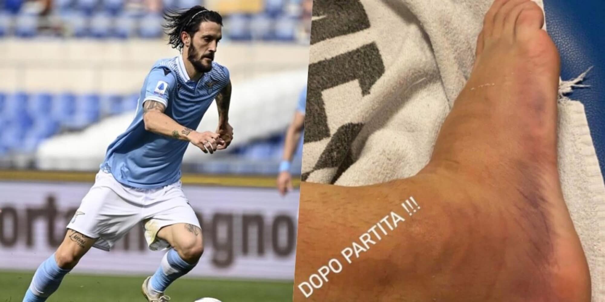 Luis Alberto, che dolore! Le immagini della caviglia