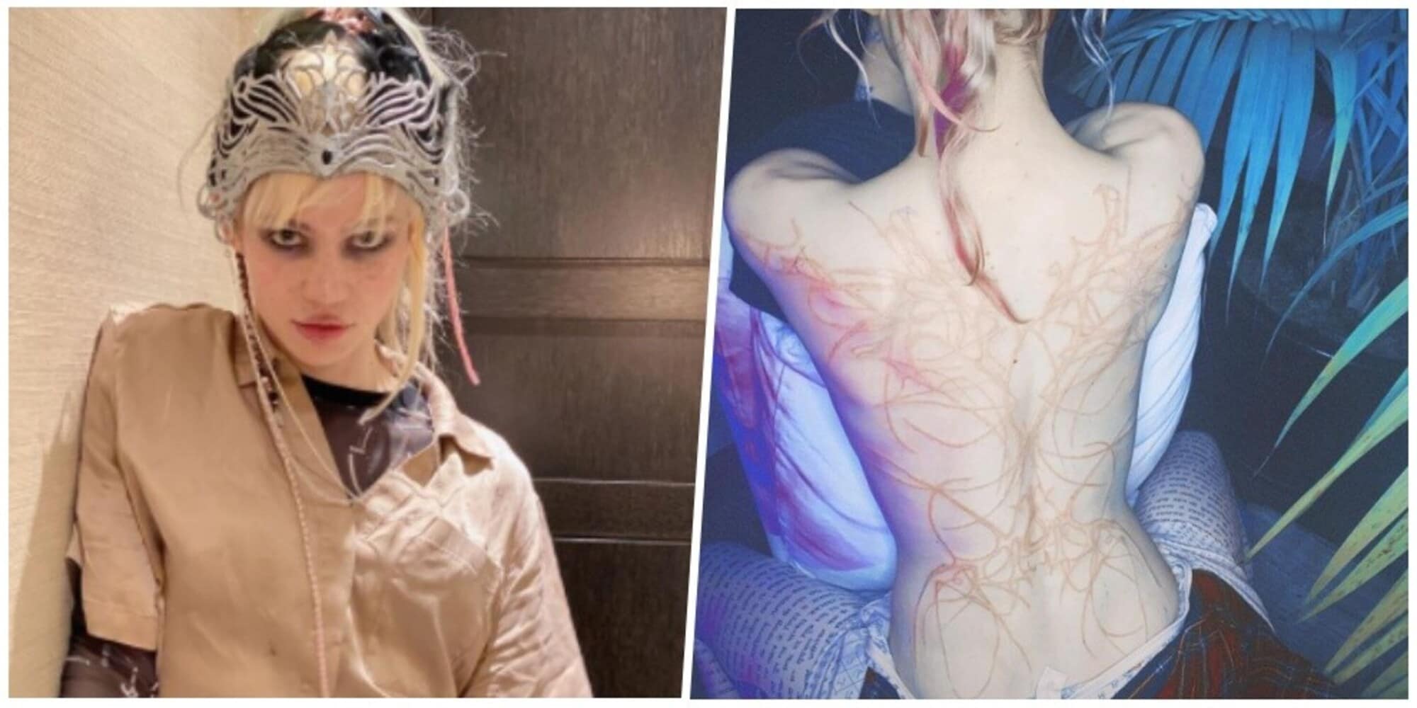 Grimes, compagna di Elon Musk, e le incredibili cicatrici aliene