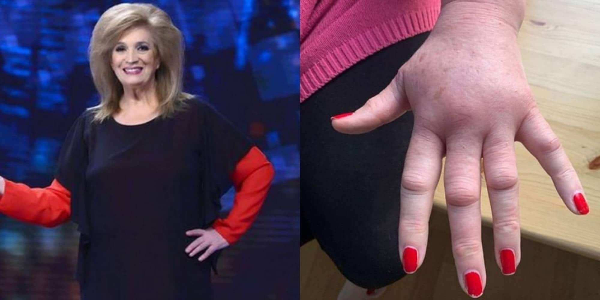 Isola dei Famosi, Iva Zanicchi shock sui social: "Ecco la mia mano"