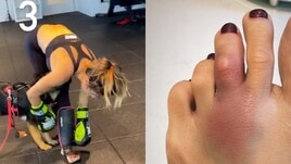 Elisabetta Canalis calcia troppo forte e si rompe il dito del piede..