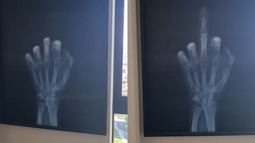 Ibra, lo scherzo social: "Ecco la mia radiografia"