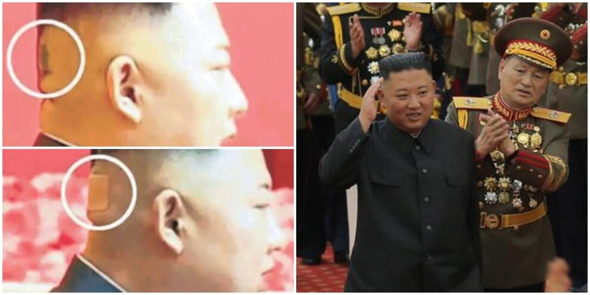 Come sta Kim Jong-un? La foto di un cerotto in testa scatena le ipotesi