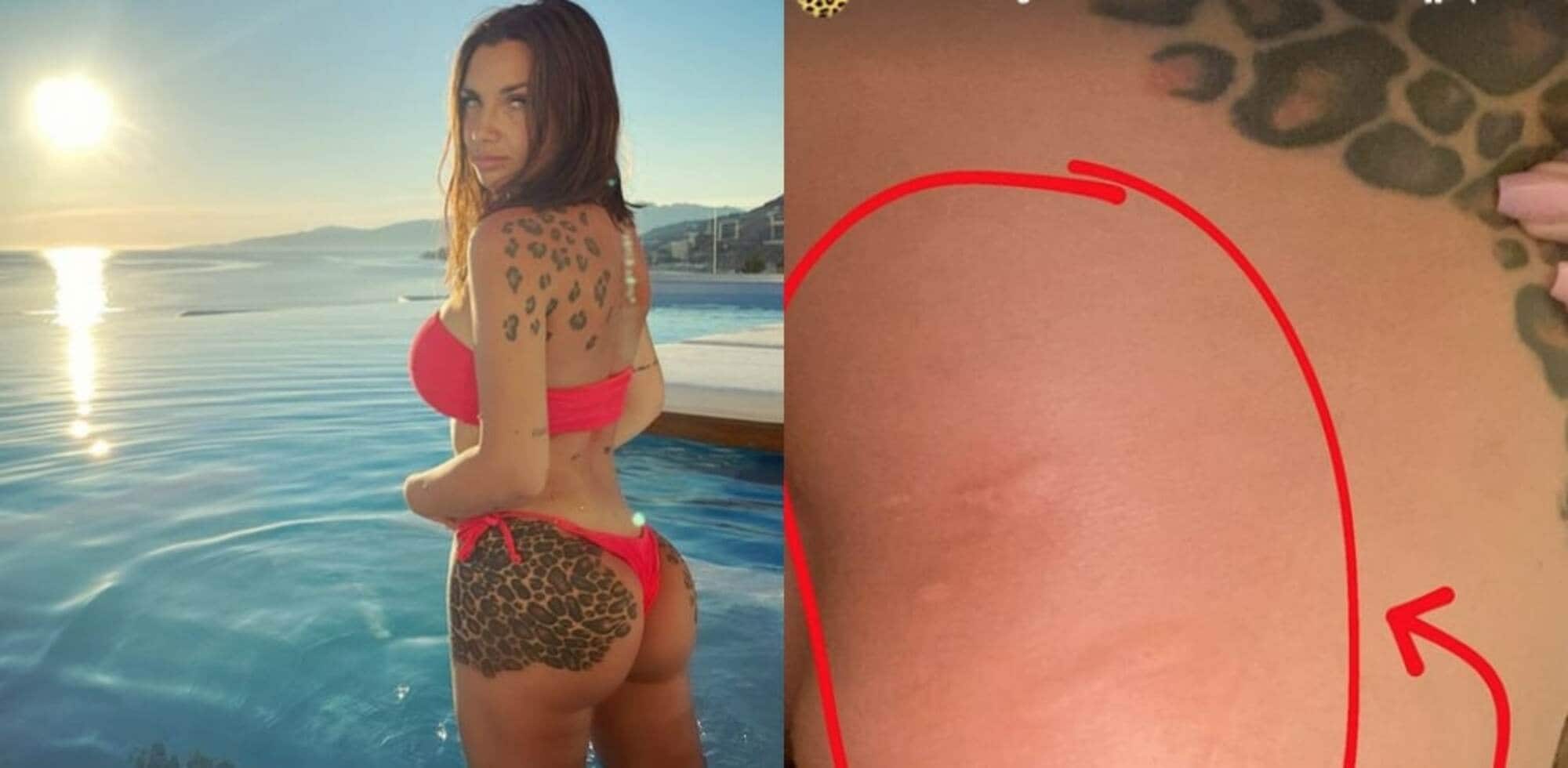 Elettra Lamborghini e l'incidente al maneggio: "Un cane mi ha morso"