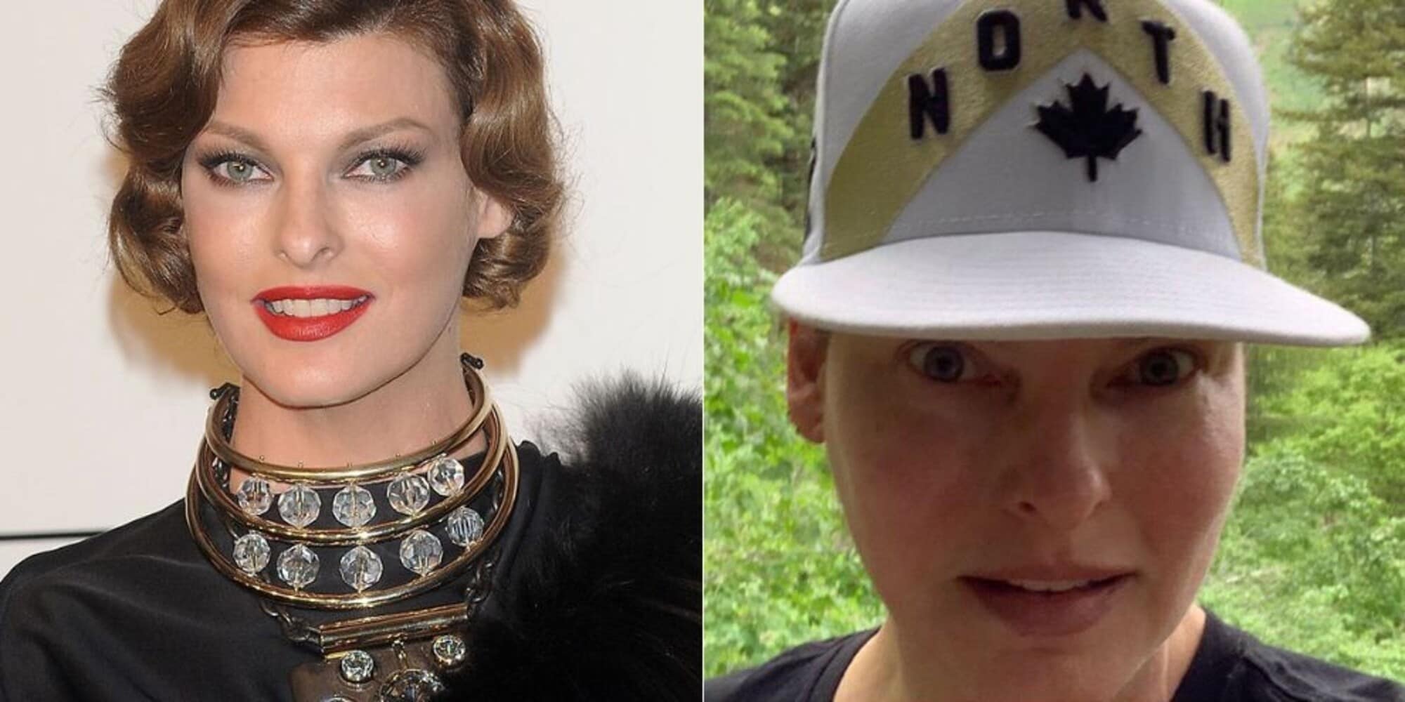 Linda Evangelista dramma: "Sfigurata dopo un trattamento estetico"