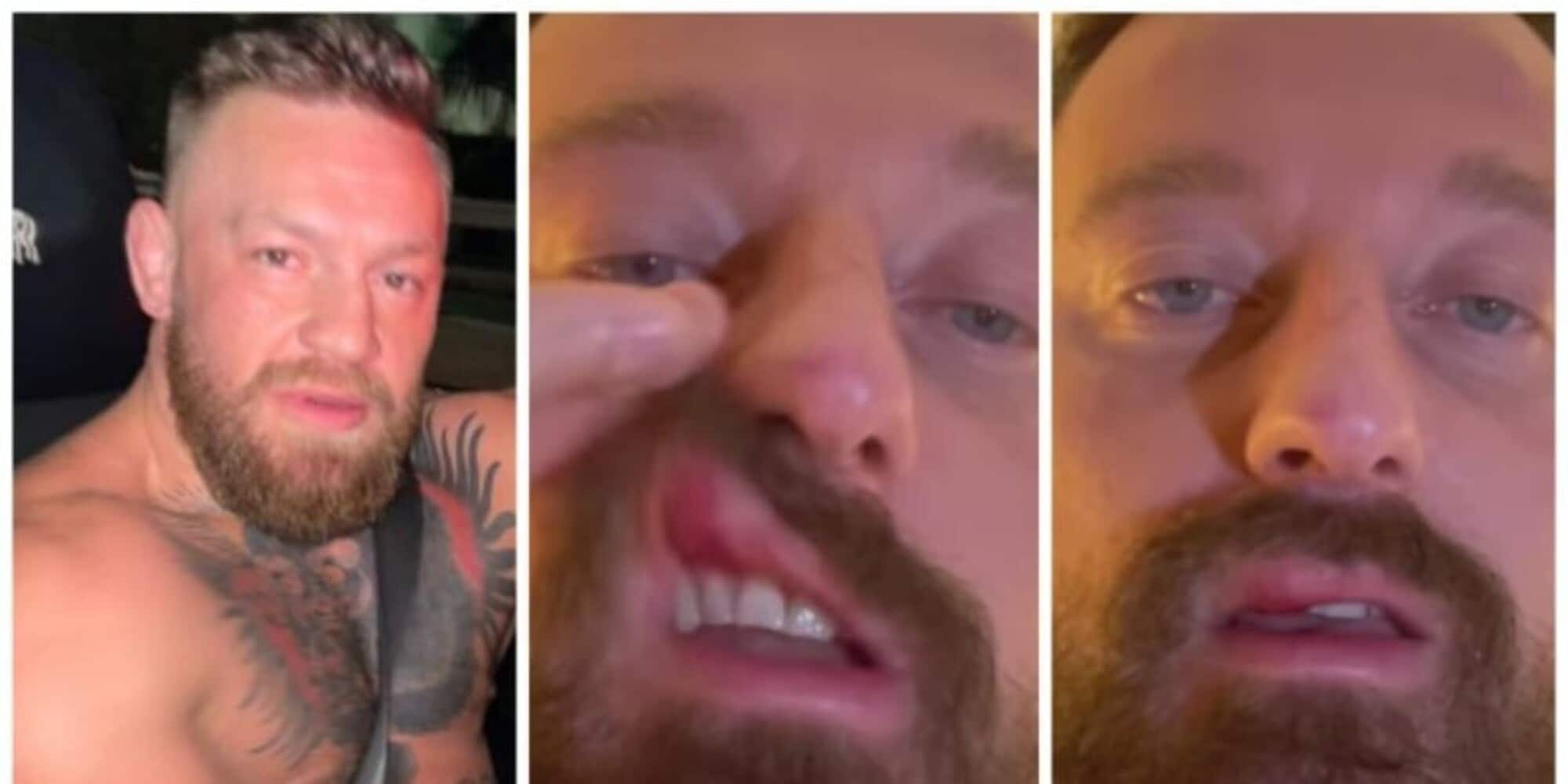 Francesco Facchinetti shock: "Conor McGregor mi ha picchiato"