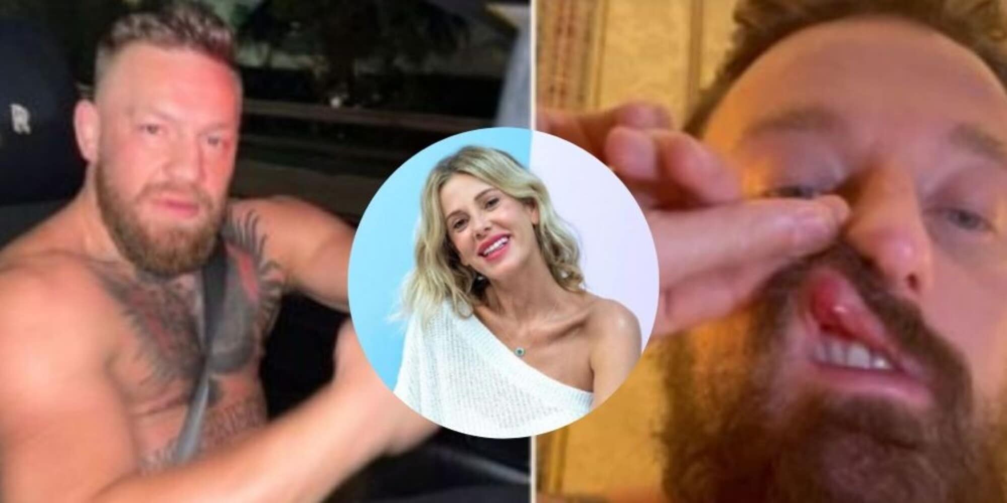 Facchinetti col collare dopo il pugno di McGregor: interviene Alessia Marcuzzi