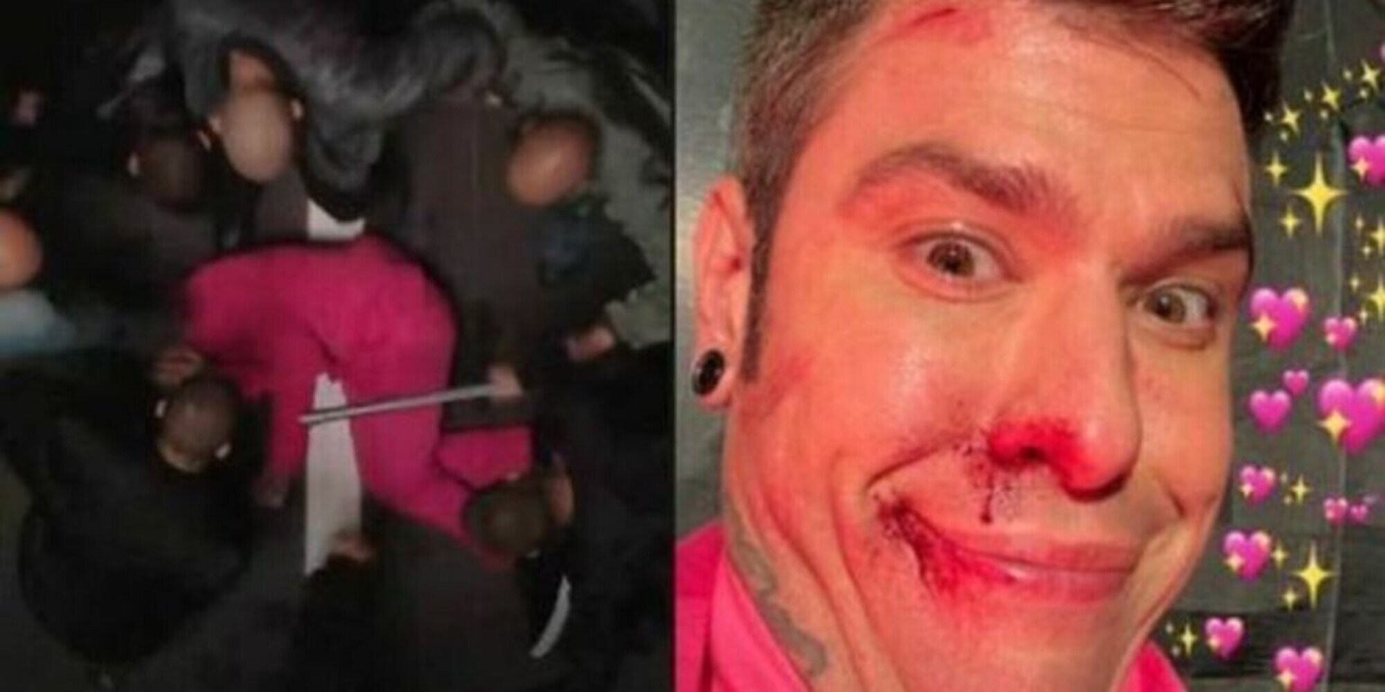 Fedez preso a bastonate da un gruppo di teppisti: l'ultima trovata del rapper