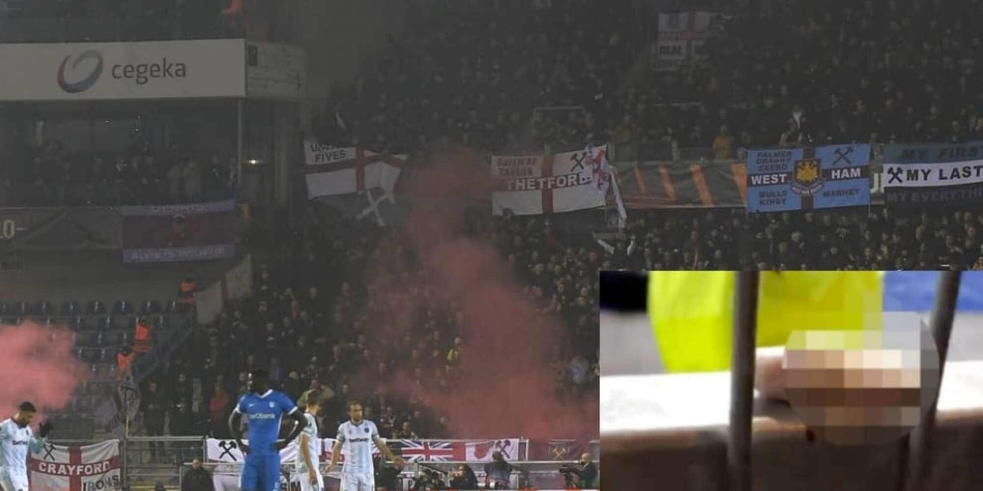 Clamoroso, perde un dito durante Genk-West Ham: come sta il tifoso inglese