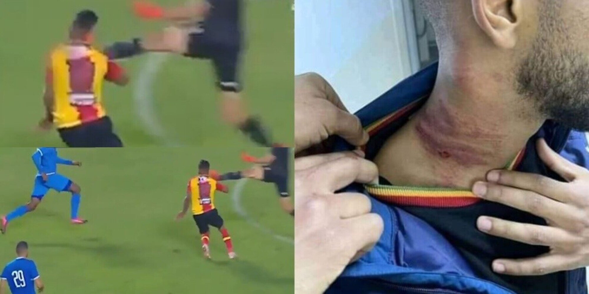 Shock nella Champions africana: "È un tentato omicidio"