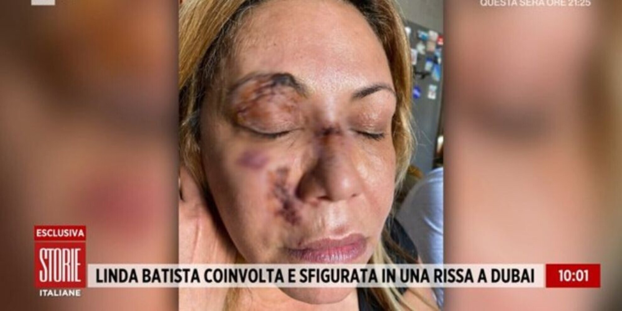 Linda Batista: l'attrice aggredita a Dubai col tacco di una scarpa