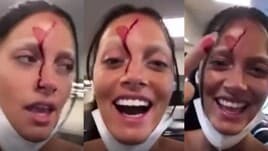 Oriana Sabatini ferita: volto insanguinato su Instagram